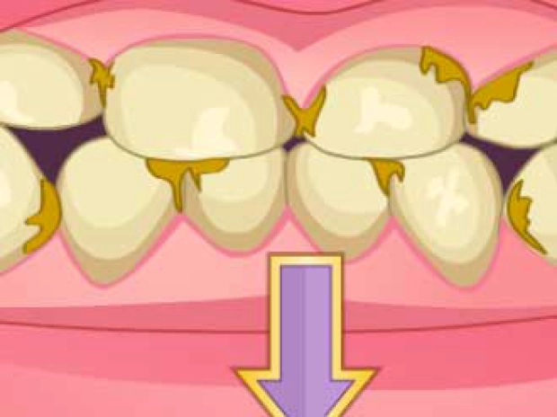 Преображение плохих зубов